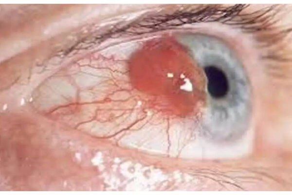 7 early signs and symptoms one should not ignore