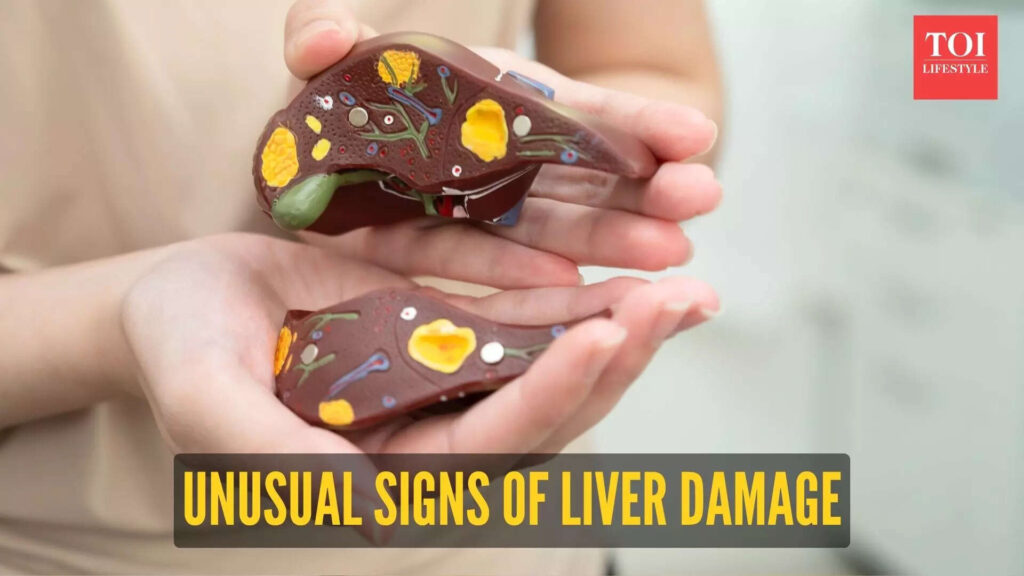 Spot these 5 signs early